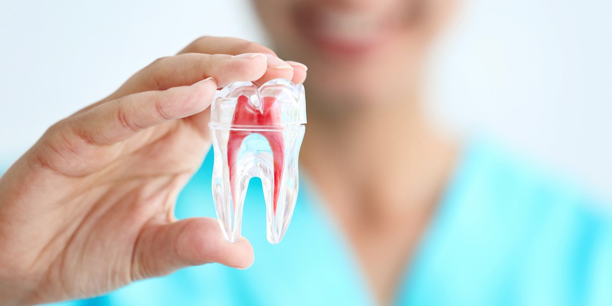 Root canal