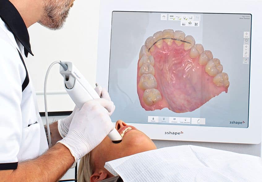 Digital scanning