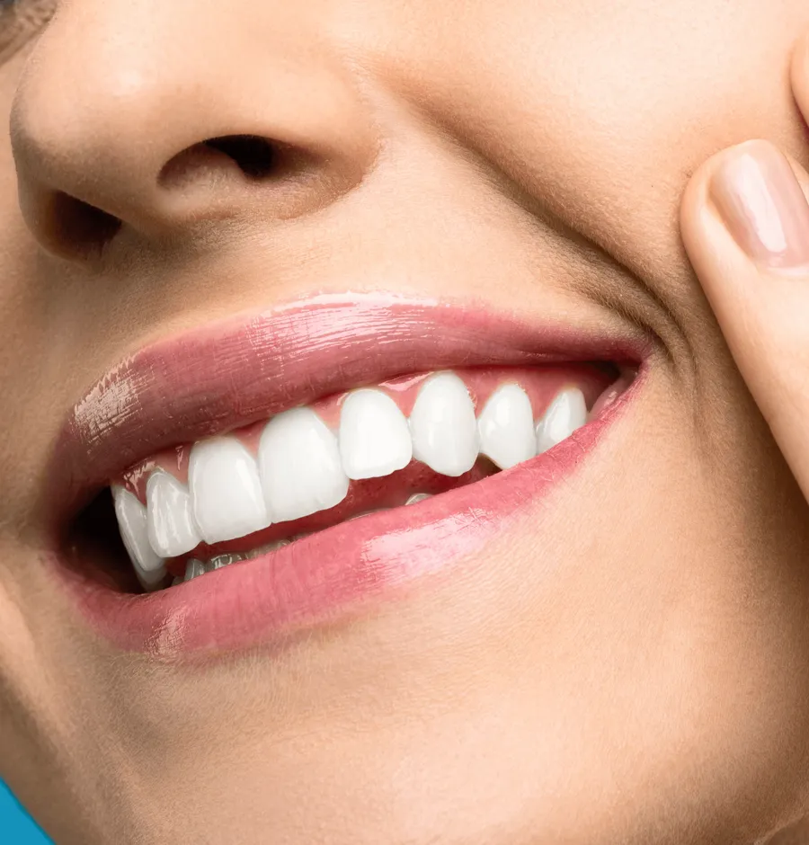 Natural healthy smile